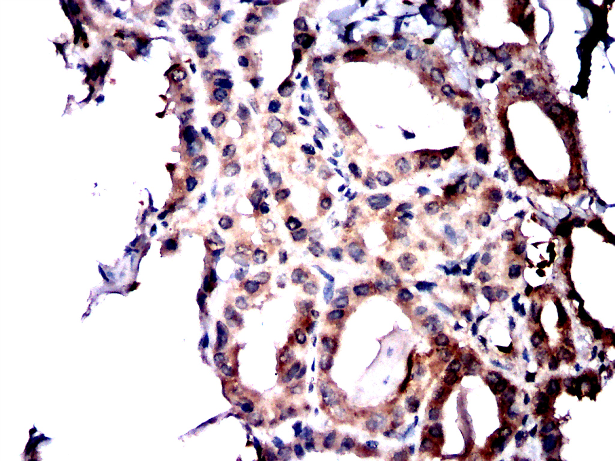                          IHC